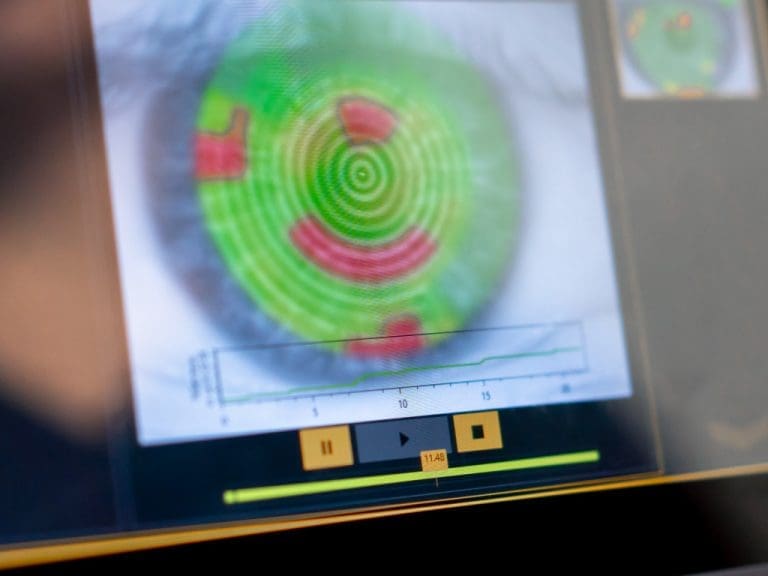 Nahaufnahme des Diagnosebildschirms mit einer Abbildung des Auges