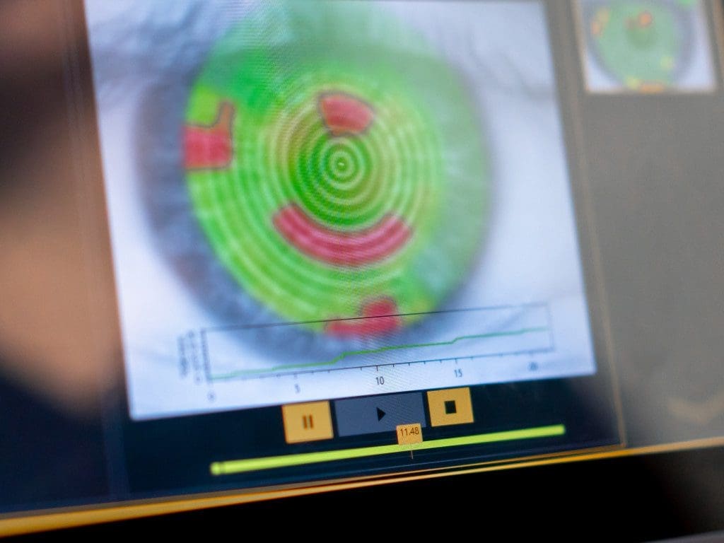 Nahaufnahme des Diagnosebildschirms mit einer Abbildung des Auges